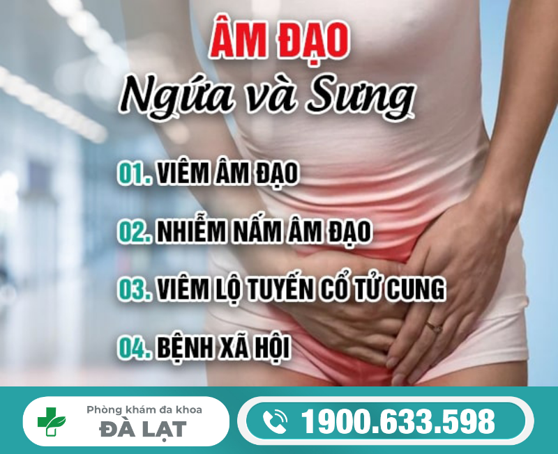 Hình ảnh minh họa